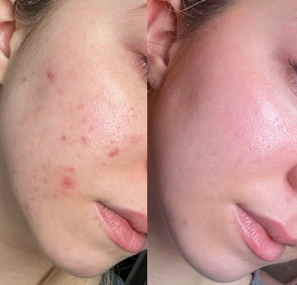 2 gammes lait de chèvre