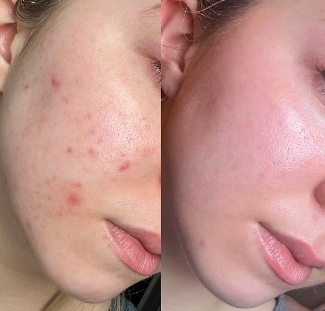 2 gammes lait de chèvre