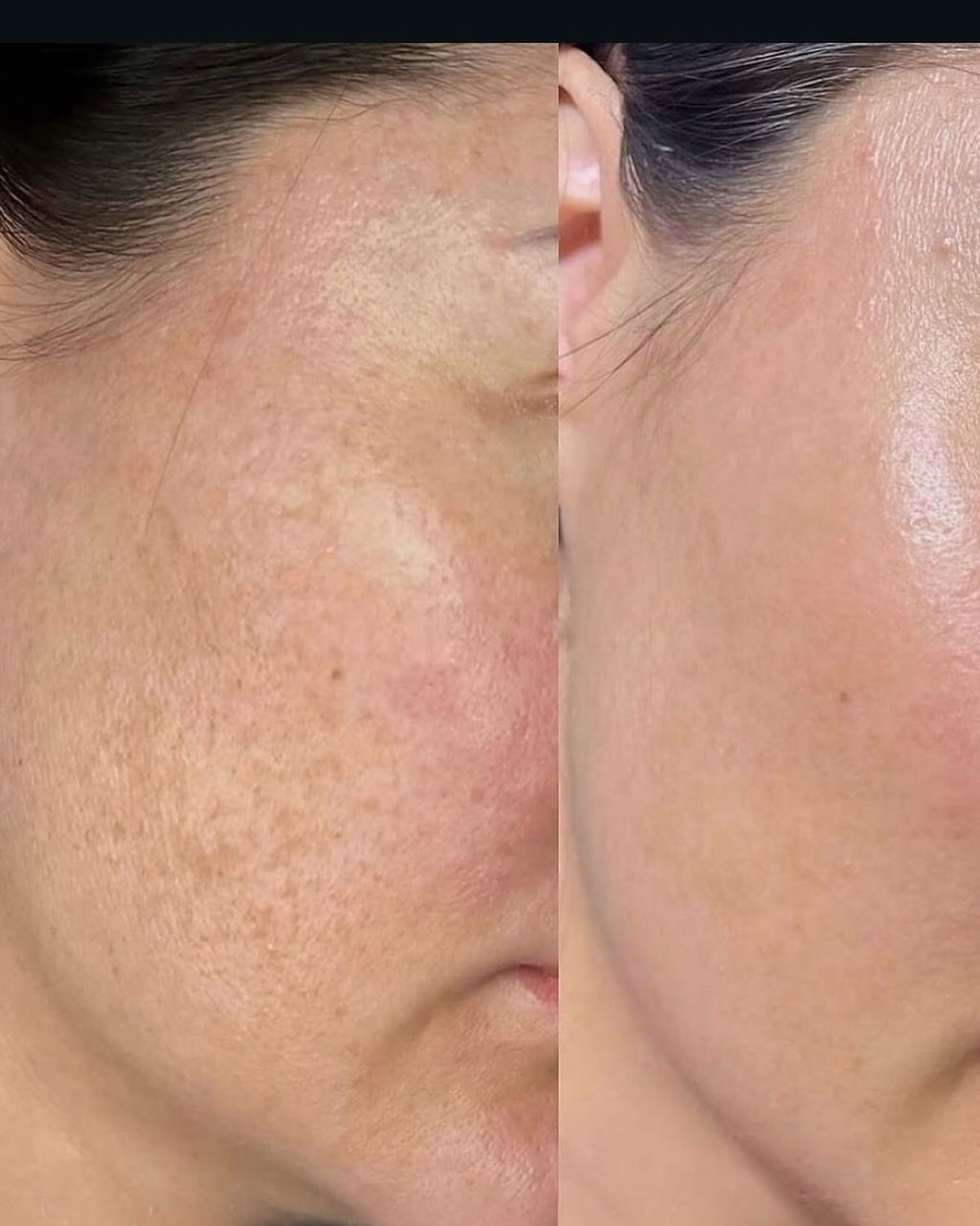 Collagen serum